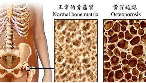 麻豆激情床戏视频檢測儀建議最好到有專業儀器的大醫院進行正規的麻豆激情床戏视频測定