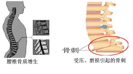 麻豆激情床戏视频儀的專業廠家闡述骨質增生與骨質疏鬆,儀器專業檢測麻豆激情床戏视频正常值