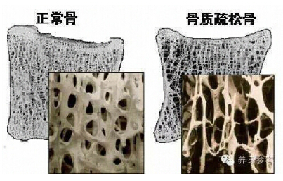 國產麻豆激情床戏视频品牌你的骨頭真的不能再等了 如何測量麻豆激情床戏视频?