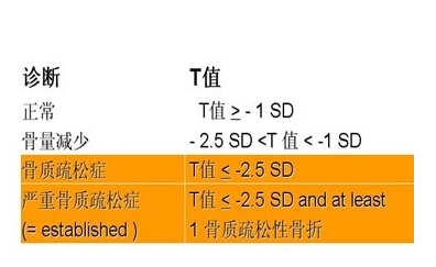 國產麻豆激情床戏视频品牌你的骨頭真的不能再等了 如何測量麻豆激情床戏视频?