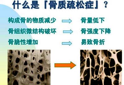 麻豆激情床戏视频檢查的儀器是什麽_麻豆激情床戏视频測試儀器專業檢測麻豆激情床戏视频預防骨質疏鬆