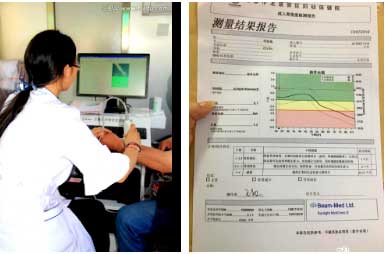 國產麻豆激情床戏视频儀能夠準確評估骨質狀態和可能發生骨折的風險早發現早治療