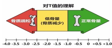 國產麻豆激情床戏视频儀三大品牌判斷骨質變化當T值<-2.5存在低骨量情況