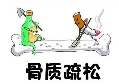 麻豆激情床戏视频檢測儀廠家排名-更容易出現骨質疏鬆的人群