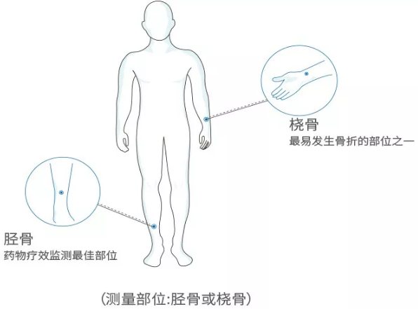 國產老年人超聲波麻豆激情床戏视频分析儀廠家